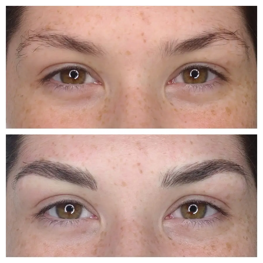 A before and after image of a woman who received a