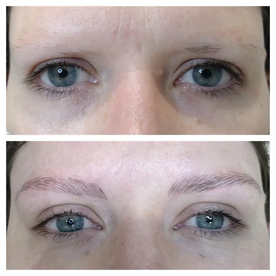 A before and after image of a woman who received a