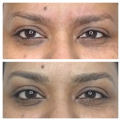 Microblading process: initial state and final result