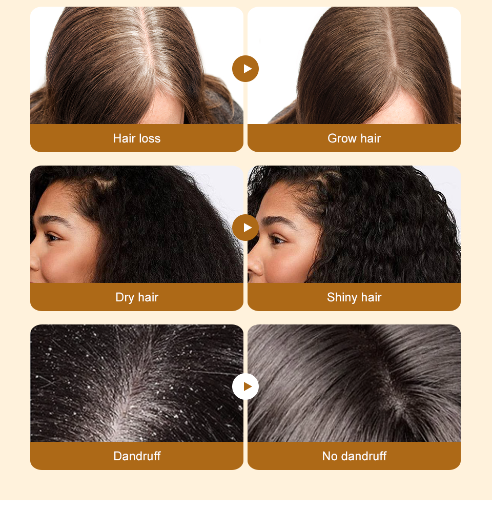 Thumbnail: Lewedo Naturals Batana Oil Fast Hair Growth