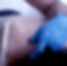 Dry-Needling
