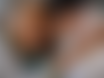 Anvisa aprova novo medicamento e especialista destaca avanço no tratamento do Alzheimer em fase inicial