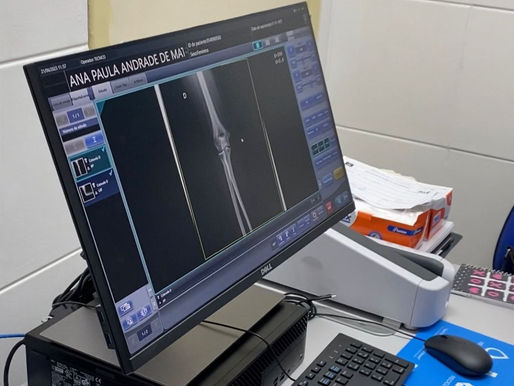 Secretaria da Saúde adquire novos equipamentos de Raio X para UPAs de Salvador