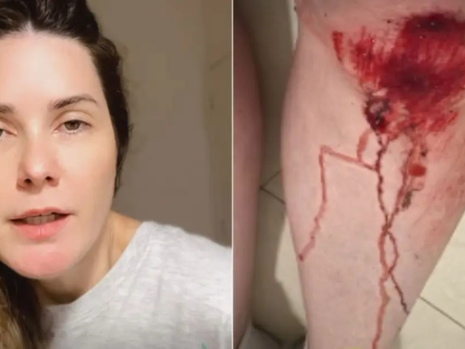 Apresentadora da Record reage a assalto e fica ferida na Ondina, em Salvador