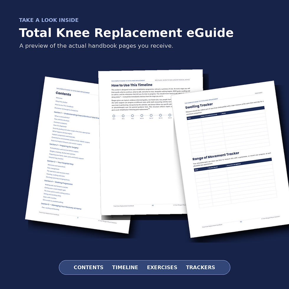 Thumbnail: Total Knee Replacement Physiotherapy Guide