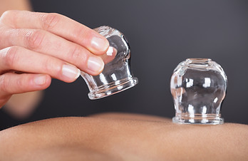 Close-up Of A Therapist Giving Cupping Treatment On Back.jpg