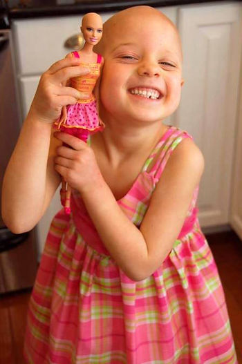 Alopecia