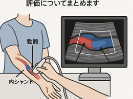 看護師さんによる在宅医療におけるエコーを科学する33~エコーで判断できること ― 内シャント(AVF)の評価