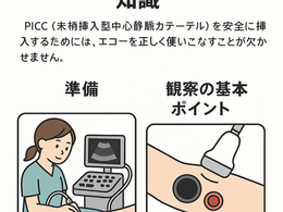 看護師さんによる在宅医療におけるエコーを科学する27~エコーでの観察アプローチのポイント