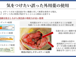 褥瘡を科学する25~褥瘡におけるポケットと浸出液対策 ― 外用薬の選び方と注意点