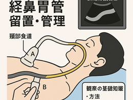 看護師さんによる在宅医療におけるエコーを科学する30~エコーでみる頸部食道と食道胃接合部の観察ポイント