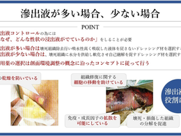 褥瘡を科学する27~浸出液コントロールの基本:なぜ、どんな液が出ているのかを知る