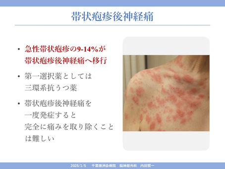 慢性難治性疼痛に対する脊髄刺激療法を科学する10
