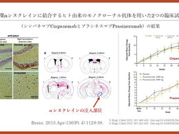 パーキンソン病を科学する25⑥~【注目の抗体治療】凝集型αシヌクレインに対するモノクローナル抗体の効果は?