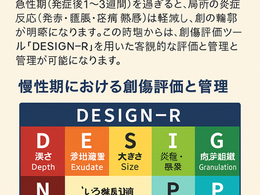 創傷ケア(スキン テア、褥瘡、下肢潰瘍)を科学する13~【褥瘡管理】慢性期における創傷評価とドレッシング材の選択