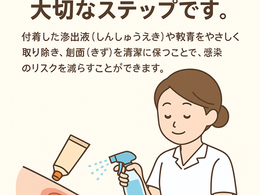 創傷ケア(スキン テア、褥瘡、下肢潰瘍)を科学する21~創傷ケアの基本:やさしい洗浄で感染リスクを減らす