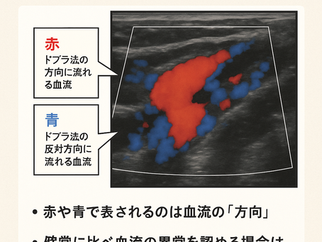 看護師さんによる在宅医療におけるエコーを科学する⑥~カラードプラ法の画像の読み方|血流の“色”から疾患を読み解く
