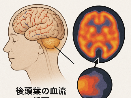 在宅医療における認知症について20~脳血流シンチグラフィで分かる認知症の特徴と限界