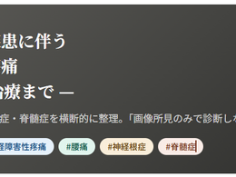 神経障害性疼痛疼痛を科学する18~脊椎・脊髄疾患に伴う神経障害性疼痛— 診断から治療まで —