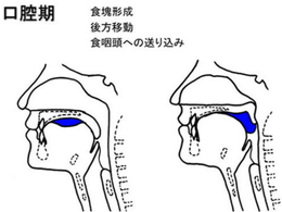 誤嚥性肺炎を予防するための在宅内視鏡検査~内視鏡検査(嚥下内視鏡)を開始しました