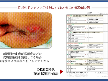 褥瘡を科学する12~湿潤環境と皮膚感染症について