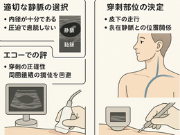 看護師さんによる在宅医療におけるエコーを科学する28~エコーでの評価・判断の手技