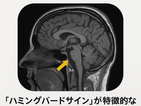 パーキンソン病を科学する35~パーキンソン病のMRI所見:見逃せない「パーキンソン+症候群」とは?