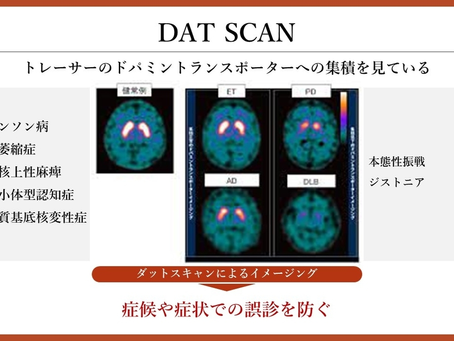 パーキンソン病を科学する40~パーキンソン病の診断に有用な「DATスキャン」とは?