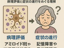 在宅医療における認知症について11~アルツハイマー病の診断とは~病理評価と症状の進行をめぐる理解~