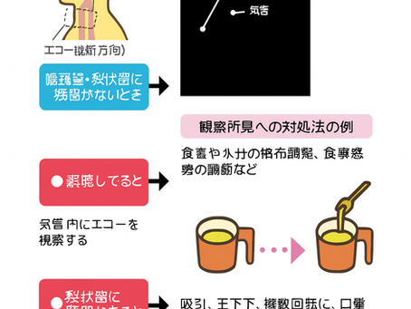 看護師さんによる在宅医療におけるエコーを科学する15~食事中の誤嚥や咽頭残留を「見える化」する ― エコーでの嚥下観察の手技と対処法 ―