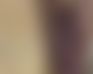 がん性皮膚潰瘍とロゼックス®ゲルのケア:在宅医療での実践と工夫