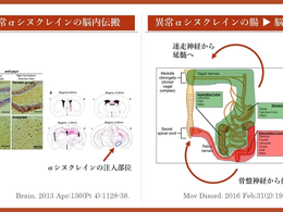 パーキンソン病を科学する6②~αシヌクレイン仮説とプリオン病の共通点