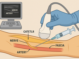 看護師さんによる在宅医療におけるエコーを科学する36~エコーで行う末梢神経ブロックとカテーテル管理