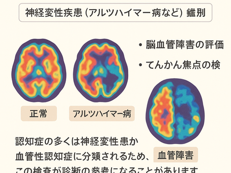 在宅医療における認知症について19~脳血流シンチグラフィで分かる認知症の特徴