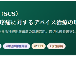 神経障害性疼痛疼痛を科学する16~脊髄刺激療法(SCS)— 慢性難治性疼痛に対するデバイス治療の理論と実践 —