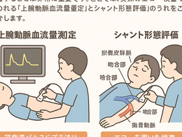 看護師さんによる在宅医療におけるエコーを科学する34~シャント機能評価における超音波の活用