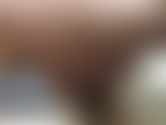 感染を防ぎ、褥創を治す方法#デブリドマン