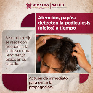 Si tu hijo se rasca con frecuencia o notas piojos y liendres en su cabello, actúa de inmediato. Prevenir la #pediculosis evita su propagación. 🚫🧐#PrimeroTuSalud