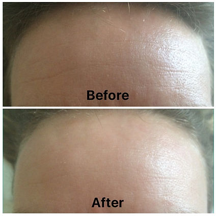 environ b&a