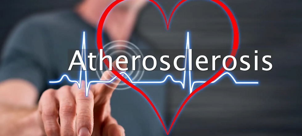 Atherosclerosis