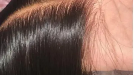 Thumbnail: HD Lace Closure or Frontal