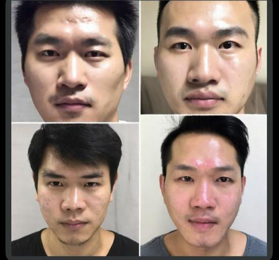 Let your skin get better and healthy look