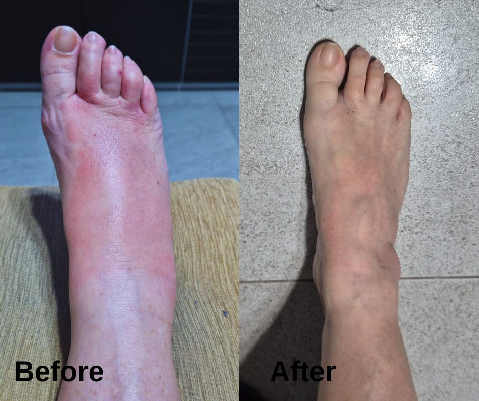 Загадочный случай - отек и зуд