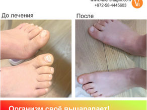 Организм своё выцарапает!