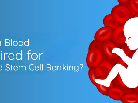 Cord Blood Stem Cell Banking