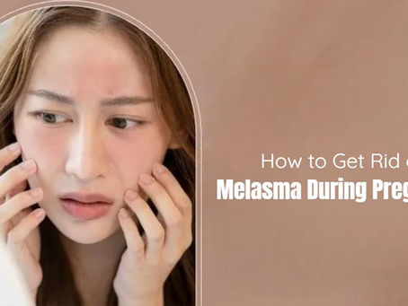 Melasma During Pregnancy