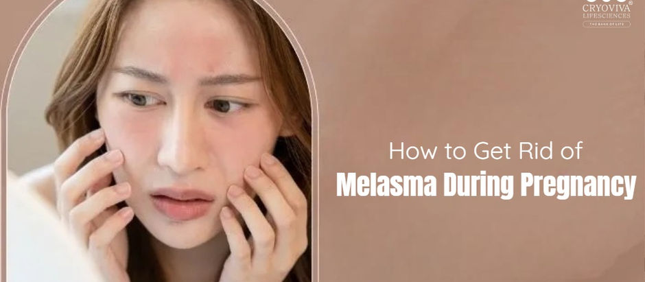 Melasma During Pregnancy