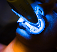 Client receiving teeth whitening treatment