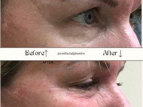 PRF Cosmetic Surgery