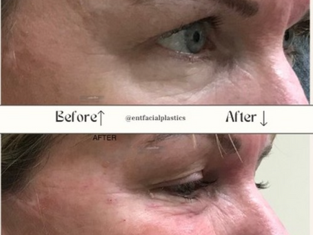 PRF Cosmetic Surgery